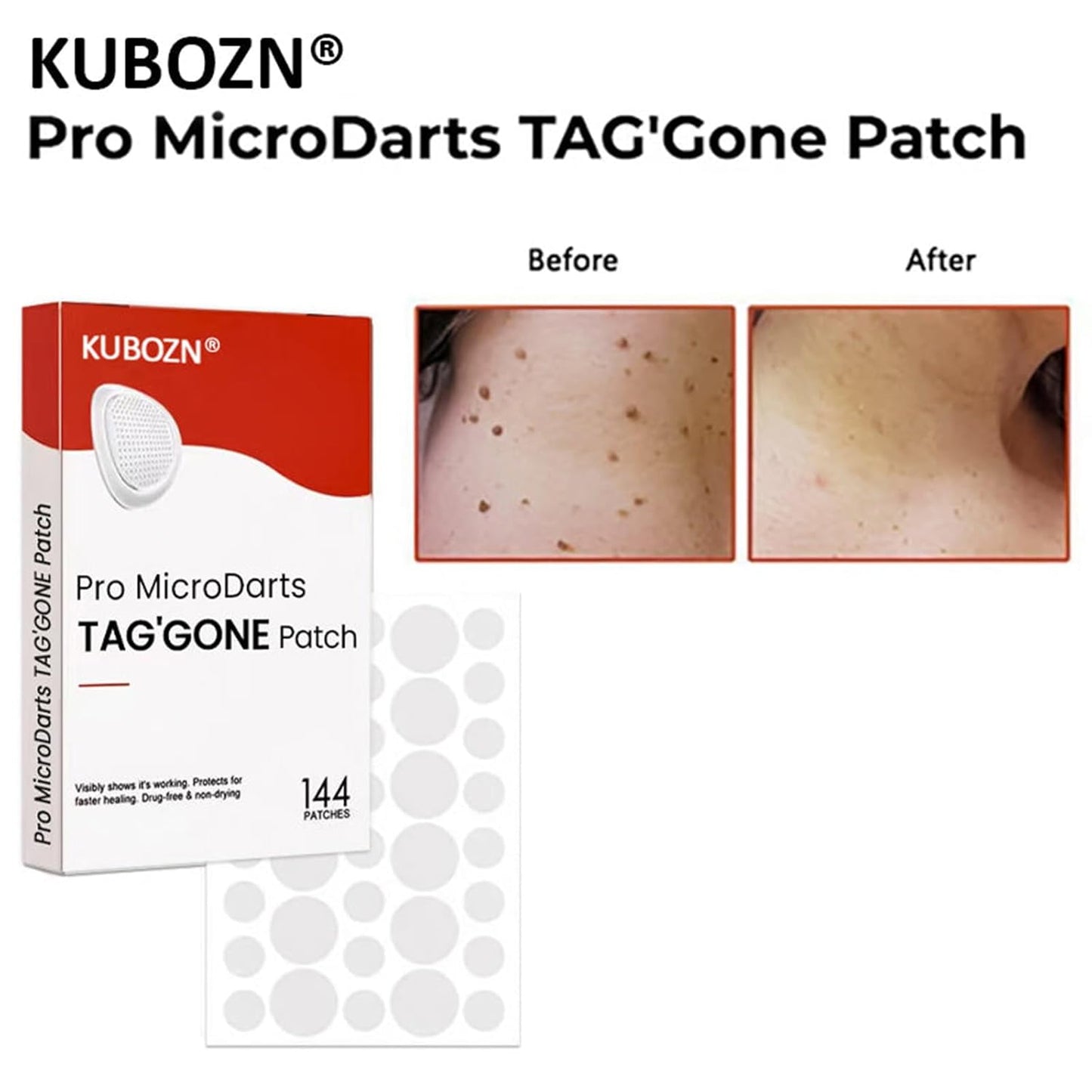 Skin Tag & Pimple Blemish Patch