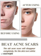 Niacid Face Serum -Skin Brightening & Anti-Aging Formula Repairs and Hydrates (Pack of 1)