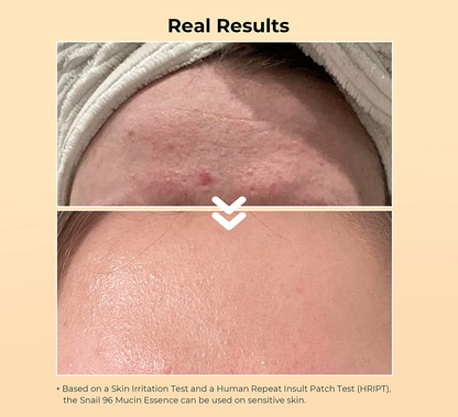 Advanced Snail Skin Booster (50ml)