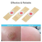 Corn Remover Pads Pack Of 12 - Foot Corn Callus Treatment