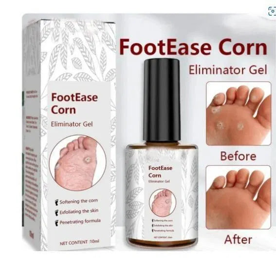 Feet Corn Removal Serum 30ml Pack Of 1