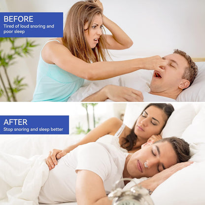 Anti Snoring Nose Clip Device for Men Women